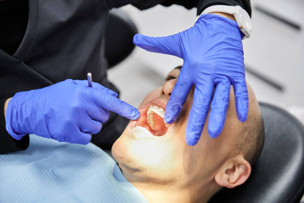 Best Emergency Wisdom Tooth Extraction in Adrian, MO